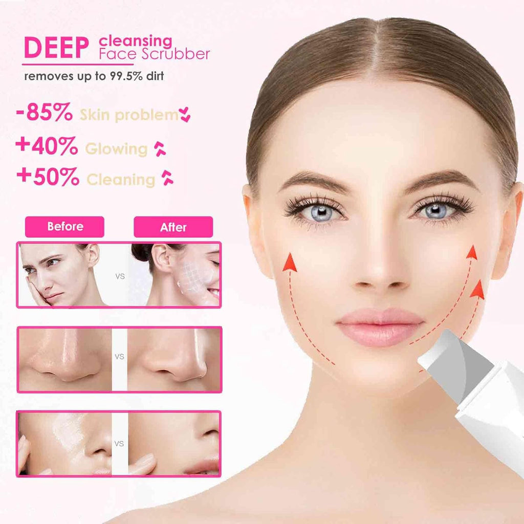 Ultrasonic Facial Skin Scrubber