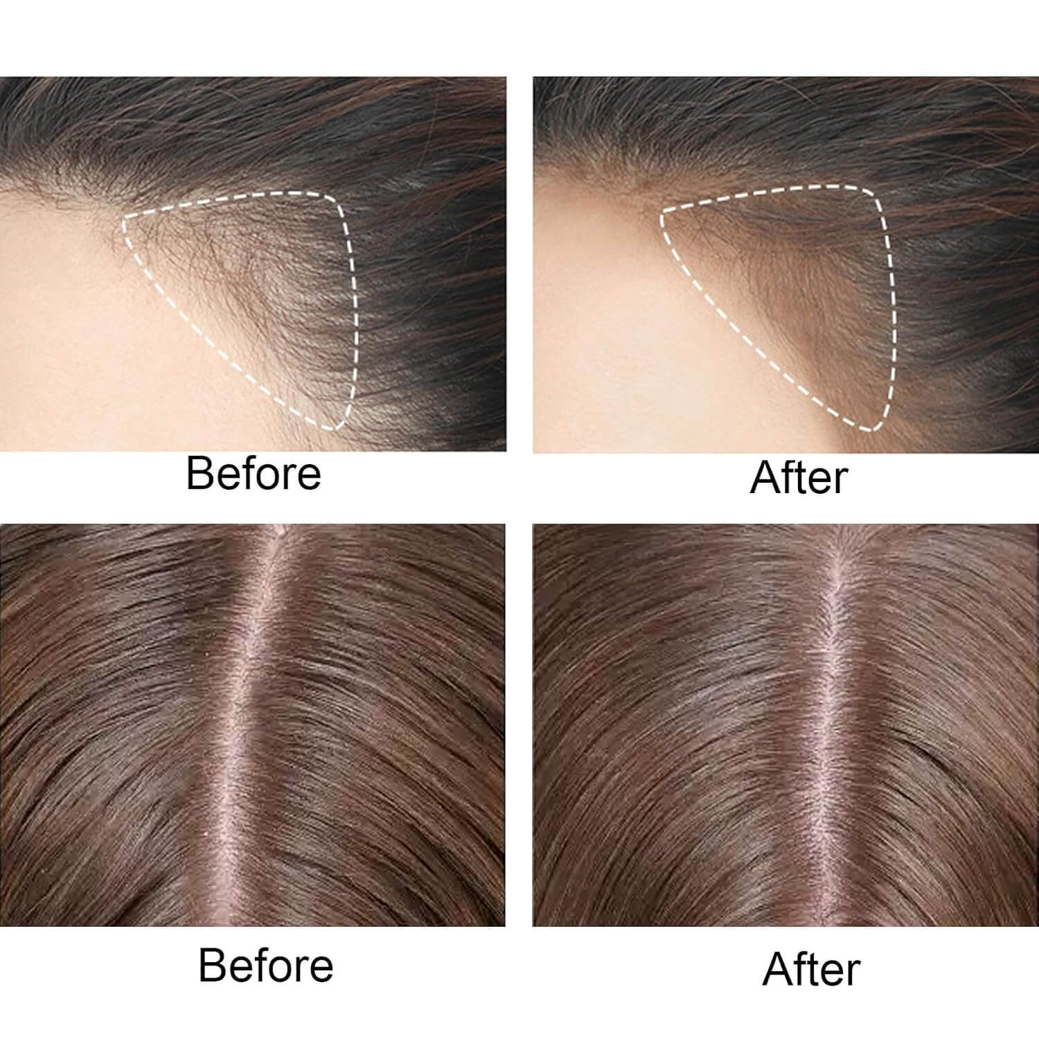 Hairline Perfect™ Instant Hair Shading Powder