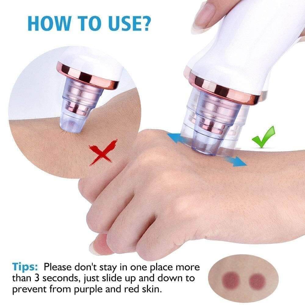 Pore Vacuum Cleaner & Blackhead Remover